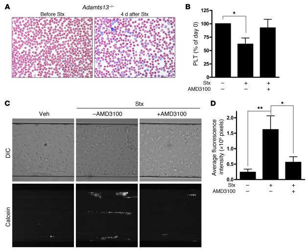 Blockade of CXCR4/SDF-1 interaction by AMD3100 restores platelet levels ...