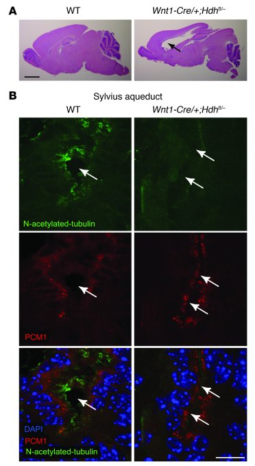 Mice lacking Htt in ependymal cells show altered PCM1 distribution, cili...