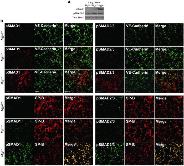 BMP activity increases as MGP levels decrease in lung tissue.
(A) pSMAD1...