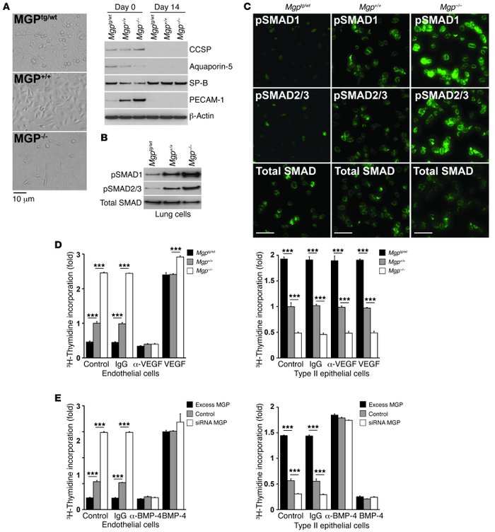 SMAD activation and proliferation in ECs versus that in type II epitheli...