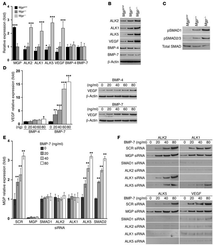 BMP-regulated gene expression is increased in MGP-deficient kidneys.
(A ...