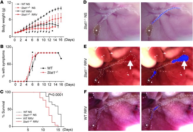 Severity of disease in Stat1–/– mice after RRV challenge.
   
The sympto...