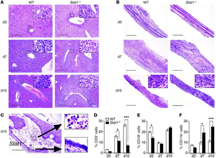 Myeloid cells infiltrate livers and bile ducts of Stat1–/– mice after RR...