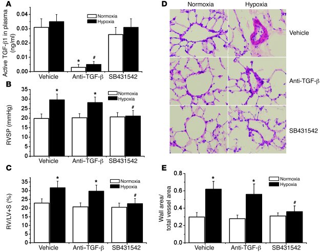 Effects of neutralizing anti–TGF-β antibody and Alk5 inhibitor SB431542 ...