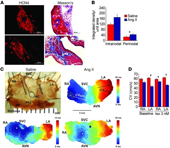 SAN and atrial fibrosis are promoted by Ang II and contribute to SND.
(A...