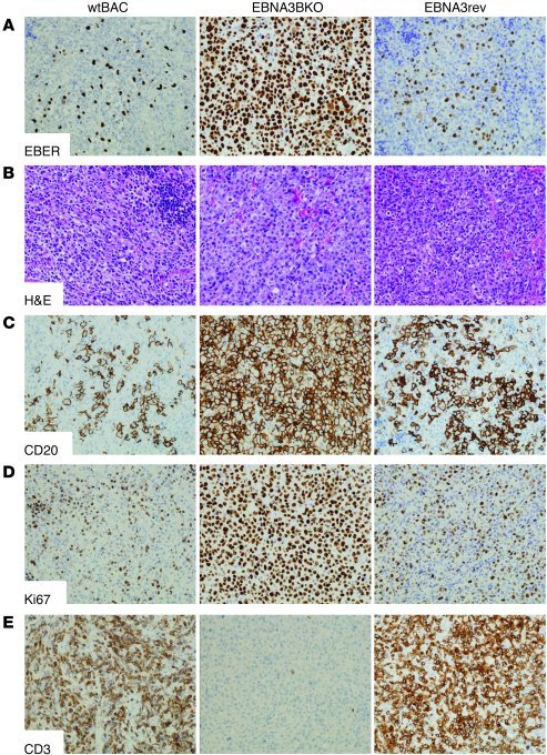 Histological and immunohistochemical features of splenic lesions in EBNA...