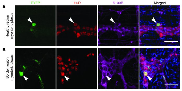 Lineage tracing in adult GFAP-CreERT2;Rosa-loxpEYFP mice detected little...