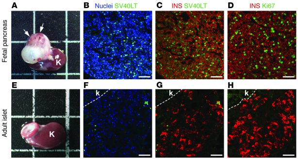 Primary insulinomas develop from SV40LT-transduced fetal pancreases, but...