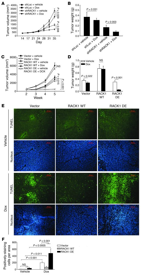 Ribosomal RACK1 modulates tumor growth of HCC in vivo.
(A and B) RACK1 d...