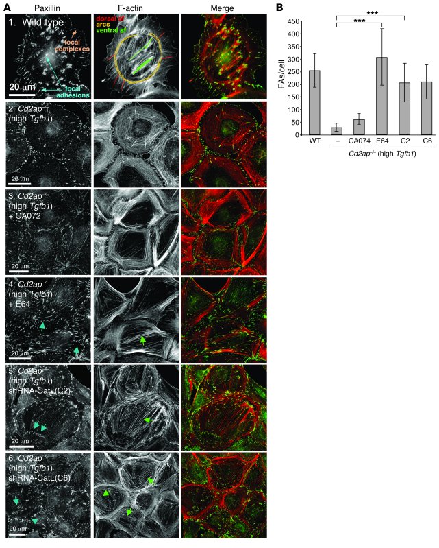 Number of FAs within WT podocytes and high-Tgfb1Cd2ap–/– podocytes with ...