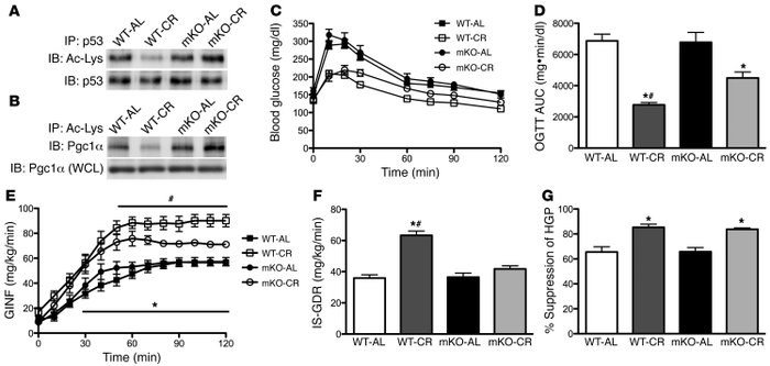 Skeletal muscle Sirt1 deacetylase activity modulates enhanced in vivo in...