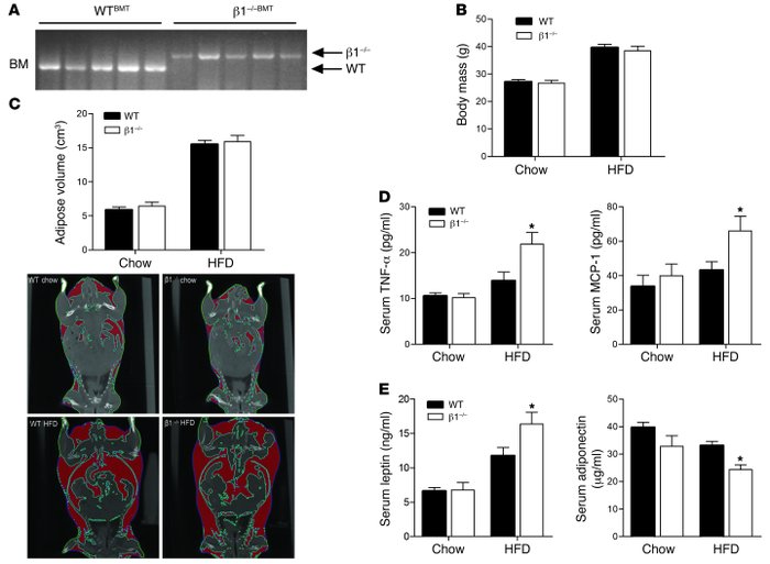 Hematopoietic deletion of AMPK β1 results in systemic inflammation despi...