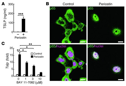 Induction of TSLP production by periostin through the NF-κB pathway in k...