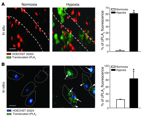 Translocation of endothelial cPLA2 in acute hypoxia.
 
(A) Representativ...