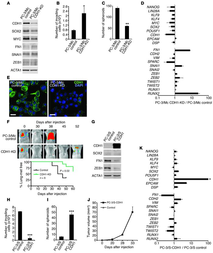 E-cadherin is required for anchorage-independent growth and lung
       ...