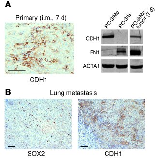 Downregulation of E-cadherin from PC-3/Mc cells at primary implantation
...