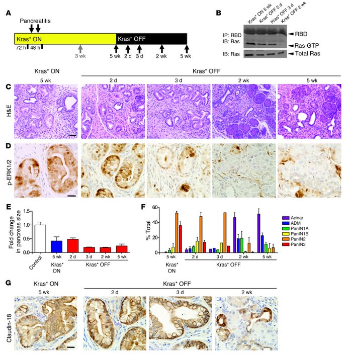 Kras* inactivation in established PanINs.
(A) Experimental design: Kras*...