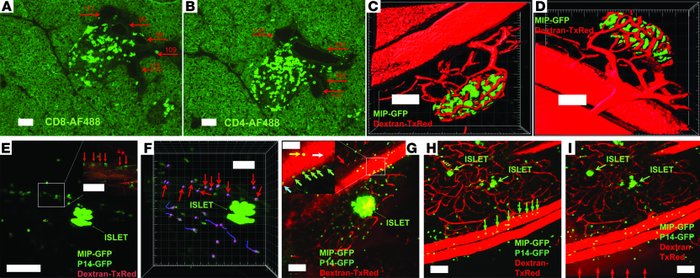 Diabetogenic CTL arrest in postcapillary pancreatic venules.
(A and B) P...