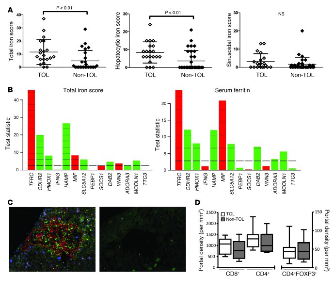 In contrast to Non-TOL recipients, TOL patients exhibit mild hepatocyte ...