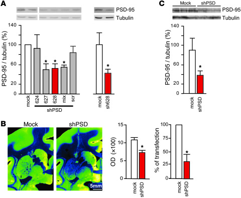 shPSD LV reduces PSD-95 levels in the MPTP-treated macaque.
(A) 3 human ...