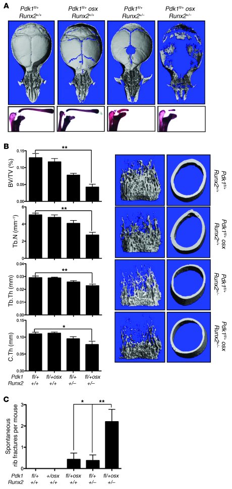 PDK1 regulates RUNX2 in vivo.
(A) μCT analysis of the calvaria (top) and...