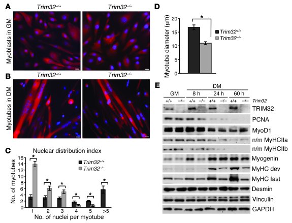 
Trim32–/– primary myoblasts have impaired differentiation in vitro.
   ...