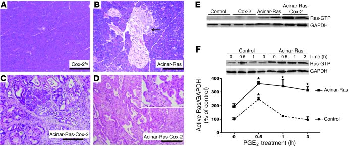 Cox-2 and oncogenic K-Ras synergized to promote the development of chron...