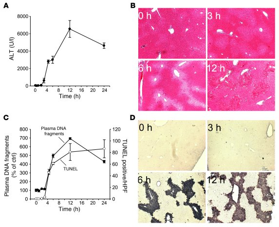 ALT activity and DNA fragments in plasma correlate with tissue injury.
M...