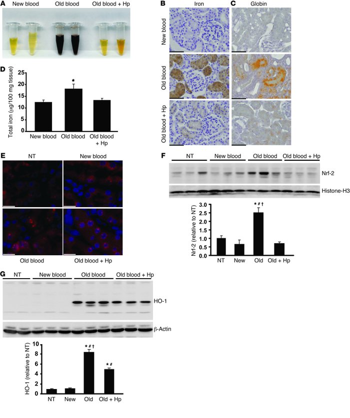 Renal Hb exposure, metabolic activation, and oxidative stress.
(A) Twent...
