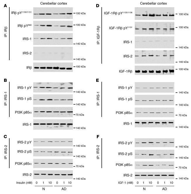 Ex vivo stimulation revealed IRS-1–associated insulin resistance and IRS...