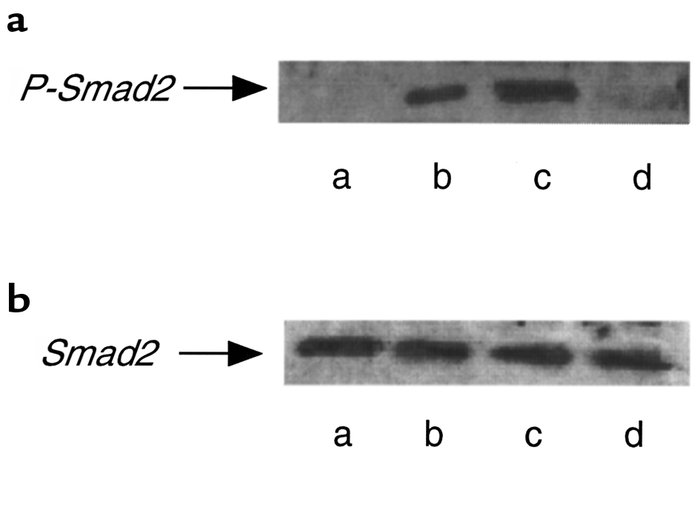 Effect of exogenous Smad7 expression on bleomycin-induced phosphorylatio...