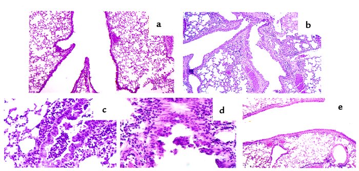 Histopathology of lung tissue from PBS (a) and SRW-sensitized and -chall...