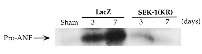 Inhibition of pressure overload–induced ANF expression by gene transfer ...