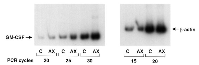 Effects of AXII on GM-CSF mRNA expression in human bone marrow cultures....