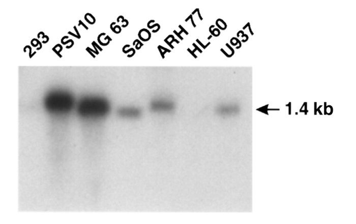 Northern blot analyses for expression of AXII mRNA. Northern blot analys...