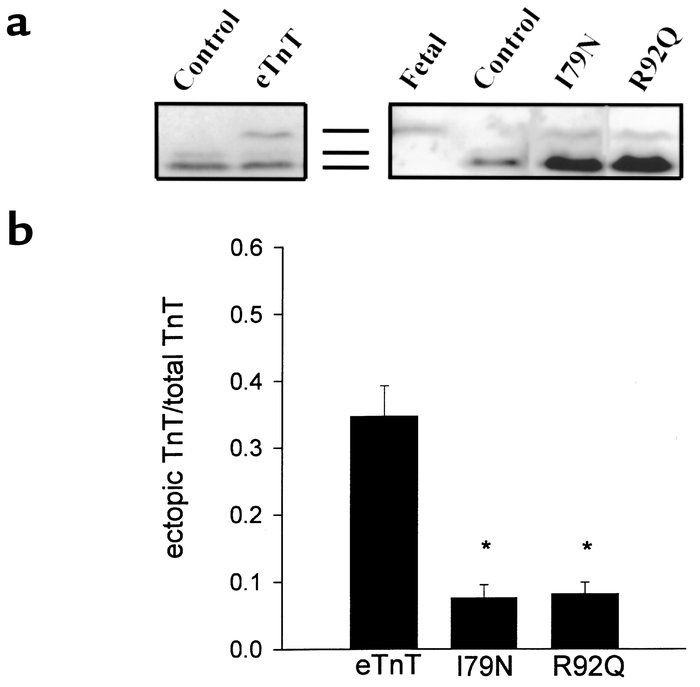 Expression of wild-type and mutant TnT proteins in adult cardiac myocyte...