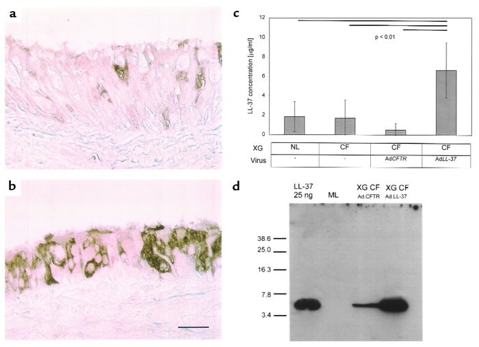 Expression of the antimicrobial peptide LL-37/hCAP-18 before and after a...