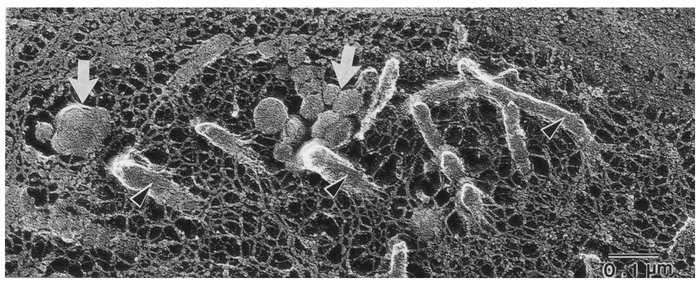 Freeze-etch electron micrograph from the intima of an E0 mouse. The arro...