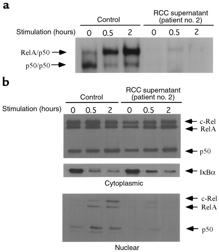 Soluble products from RCC explants suppress NFκB activation in normal T ...