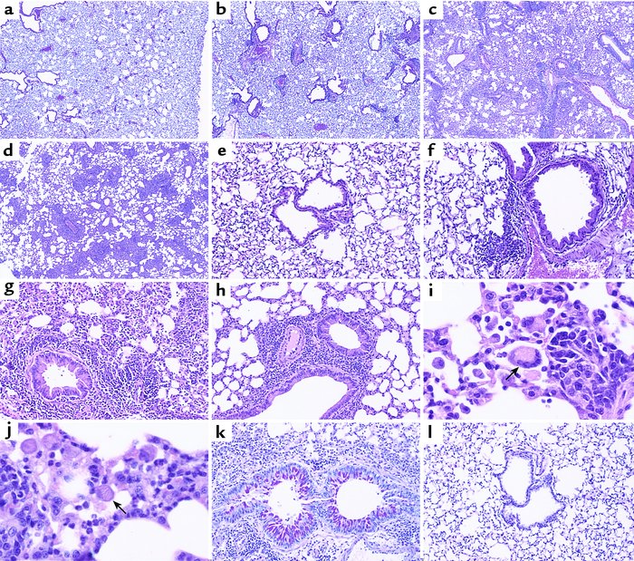 (a–l) Lung histopathology showing increased inflammation in PGHS-deficie...