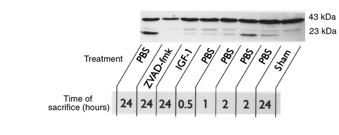 Posttranslational processing of the EMAP-II protein is induced in parall...