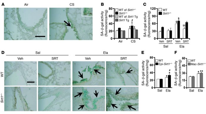 SIRT1 protects against CS- or elastase-induced increase in lung SA–β-gal...