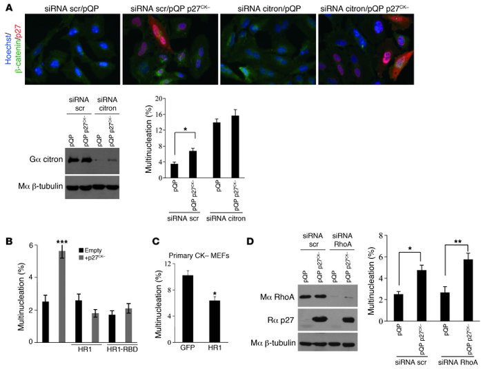 p27CK– interferes with citron-K function.
   
(A) p27CK– does not affect...