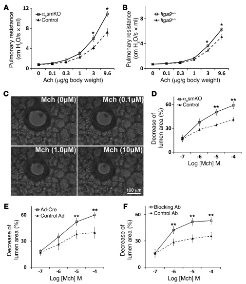 Integrin α9β1 plays a protection role in airway hyperresponsiveness.
 
(...