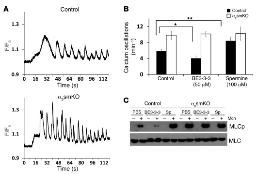 Airway smooth muscle cells in α9smKO lung slices have increased calcium ...