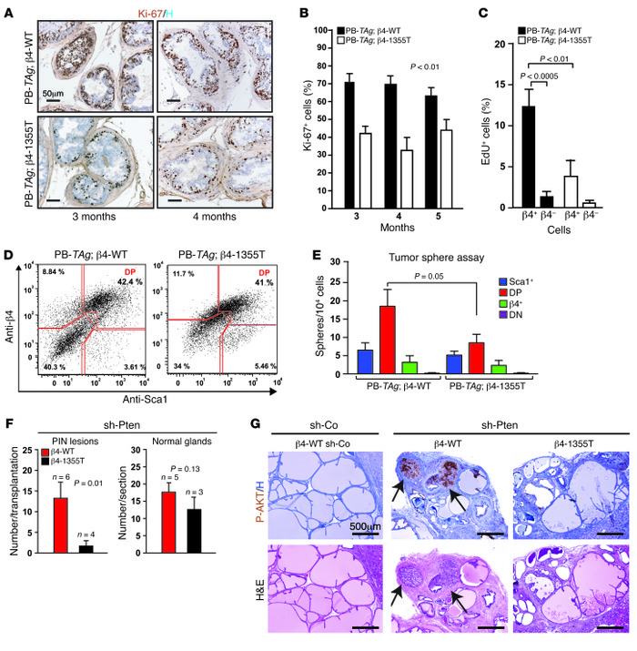 Deletion of the β4 signaling domain inhibits the manifestation of cancer...