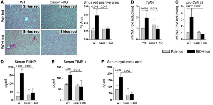 Deficiency of Casp-1 attenuates alcoholic liver fibrosis.
WT or Casp-1–K...