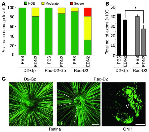 Restoring EDN2 to radiation-treated eyes induces a pattern of damage tha...