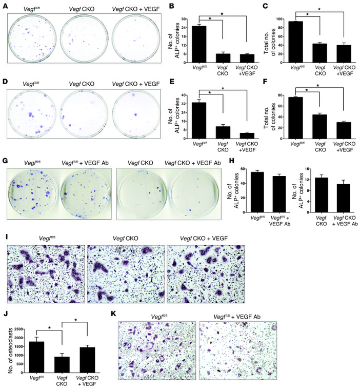 Suppressed osteoblastogenesis resulting from VEGF deficiency in CFU-F as...