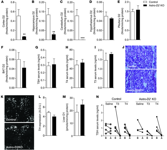 Thyroid phenotype in astro-D2 KO mice versus GFAP-cre controls.
 
(A–F) ...